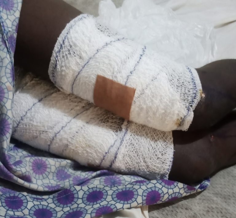 Ogun Police Arrest Woman for Torturing 11-Year-Old Girl with Burning Coal over Stolen Fish